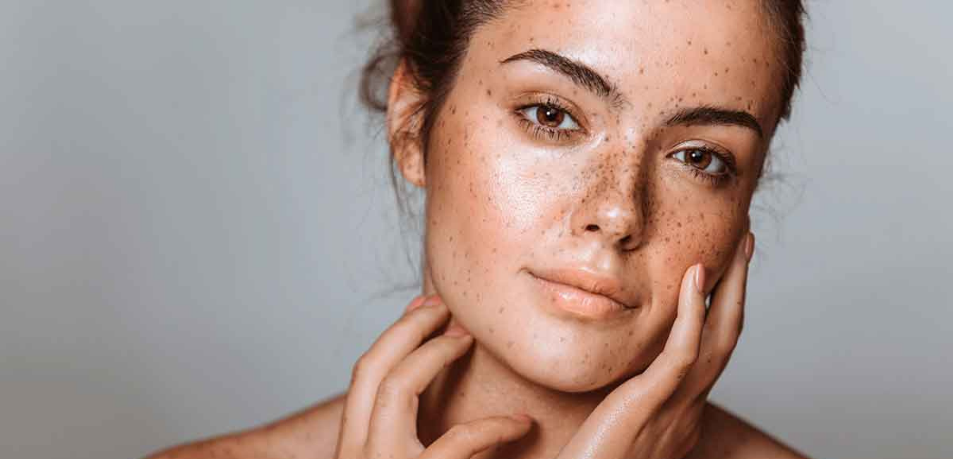 Your Guide to Pigmentation