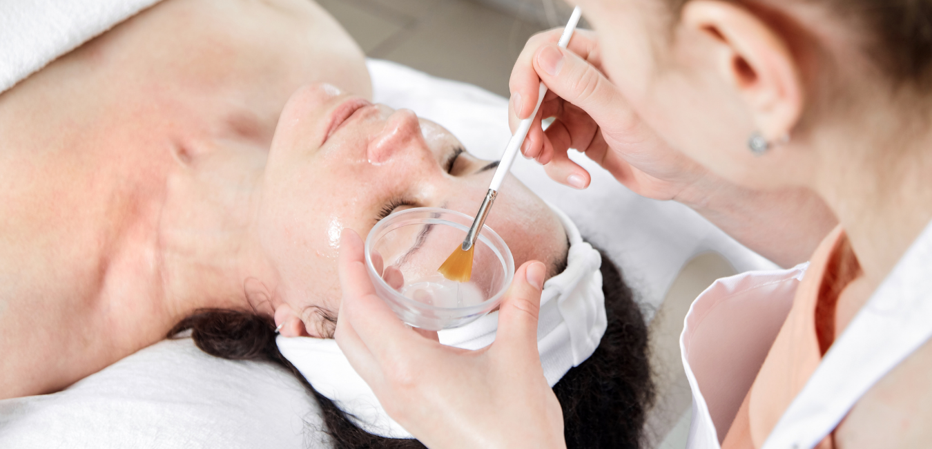 Chemical Peels Explained